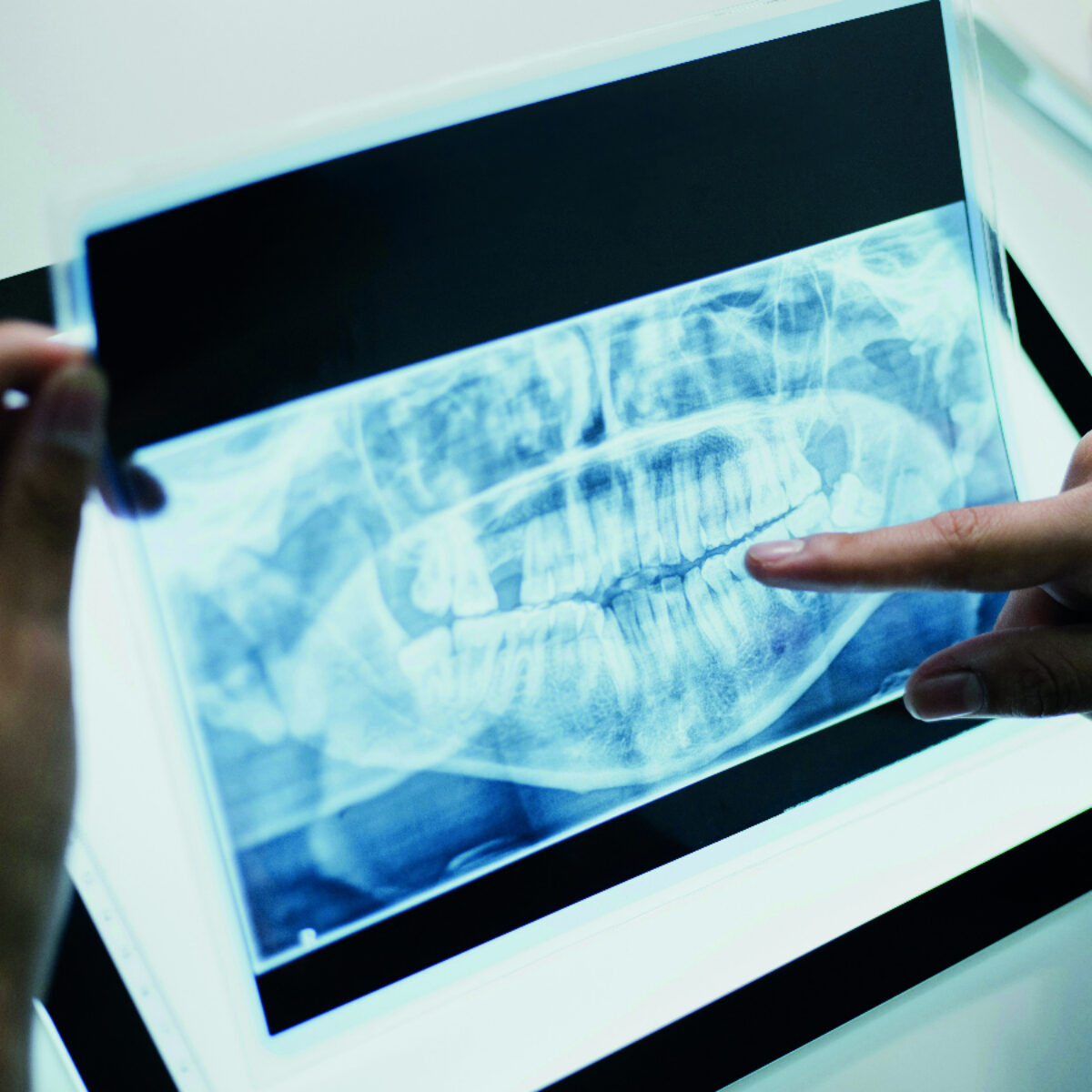 square-image(33) Popikone 6