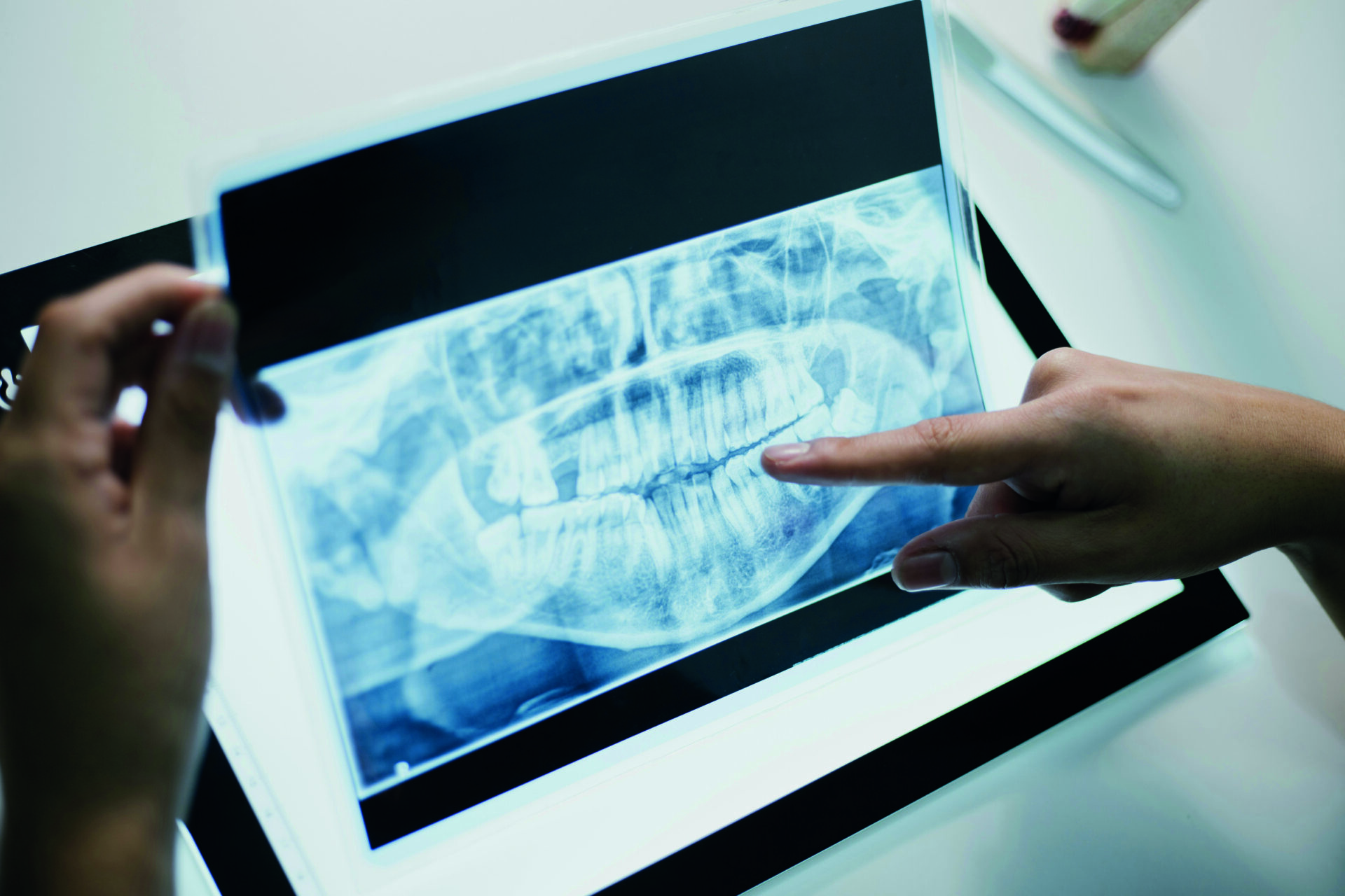 Wenn der Kiefer Druck macht 2 Wenn der Kiefer Druck macht 1