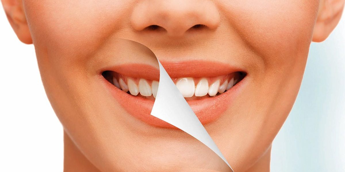 Schöne Zähne kann jeder haben – Lebensart Med