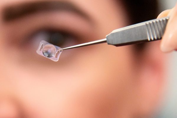 Augenklinik Roth • Freiheit im Blick